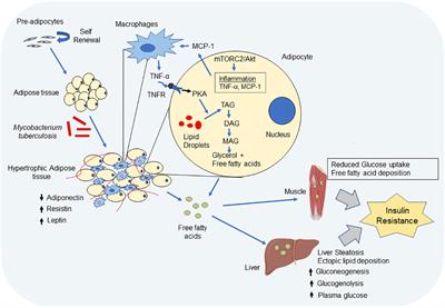 The cause–effect relation of tuberculosis on incidence of diabetes mellitus